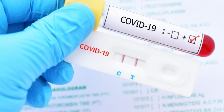 Prueba rápida de Covid-19